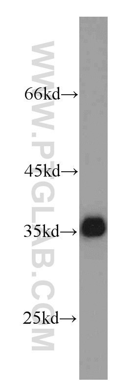 10494-1-AP;HeLa cells