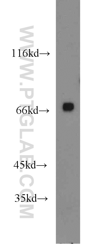 13937-1-AP;mouse testis tissue