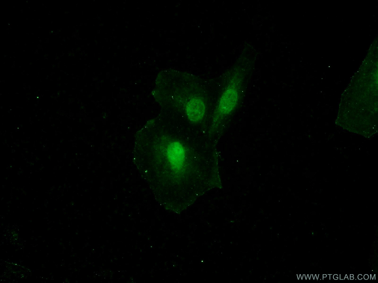 25679-1-AP;A549 cells