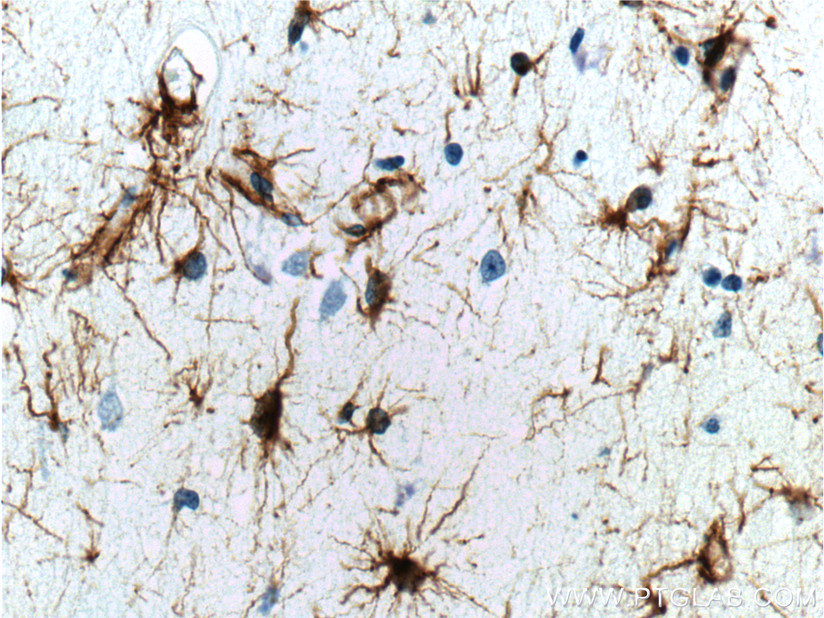 16825-1-AP;human brain tissue