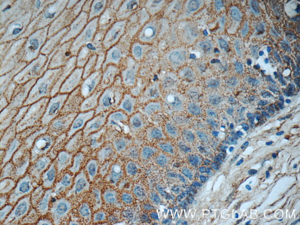 12880-1-AP;human cervix tissue