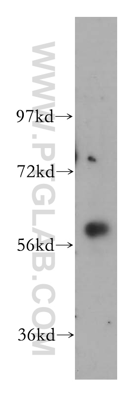 14176-1-AP;HeLa cell