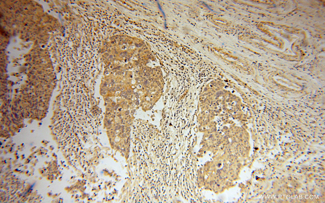 15717-1-AP;human ovary tumor