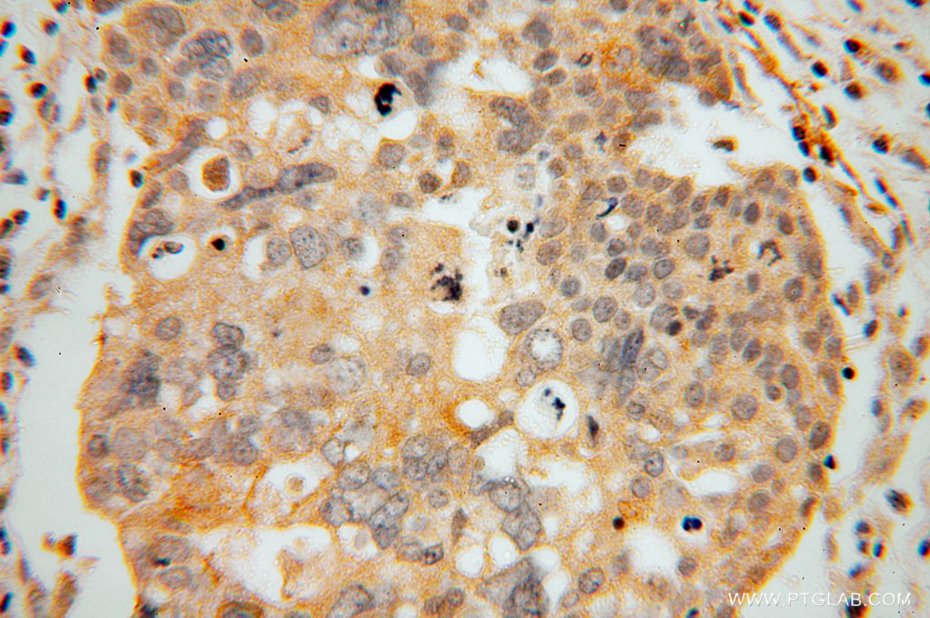 15717-1-AP;human ovary tumor