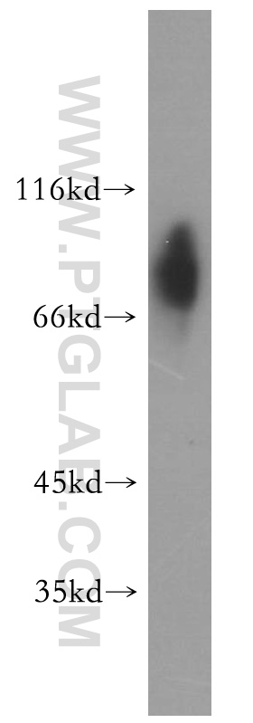 13314-1-AP;human placenta tissue