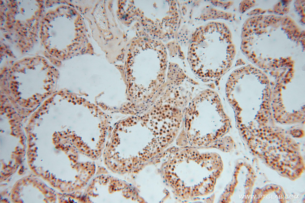 15388-1-AP;H-testis