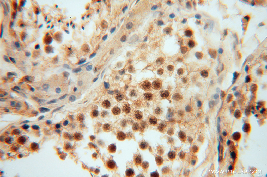 15388-1-AP;H-testis