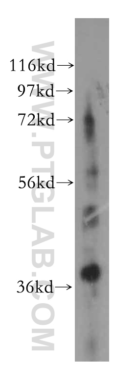 15388-1-AP;human liver tissue
