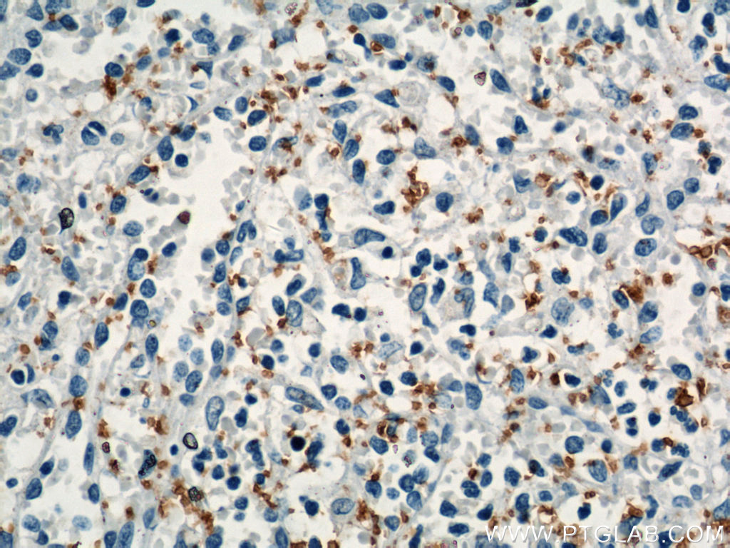 12860-1-AP;human spleen
