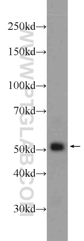 24399-1-AP;HEK-293 cells