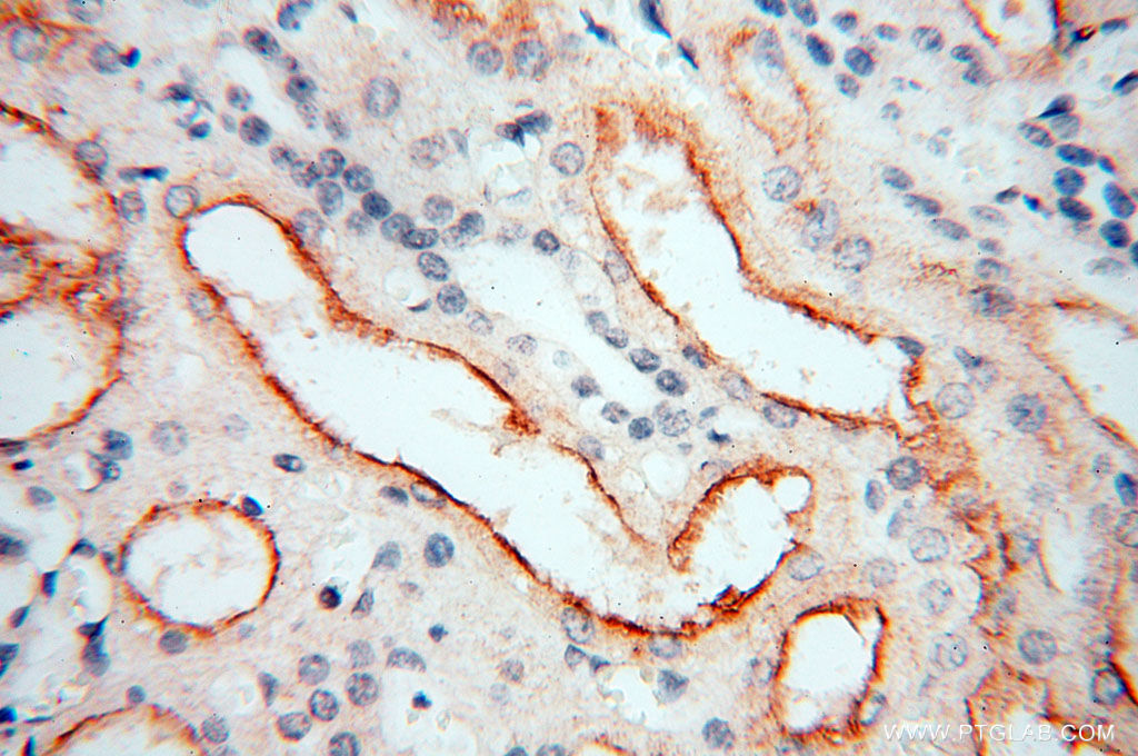 17026-1-AP;human kidney tissue