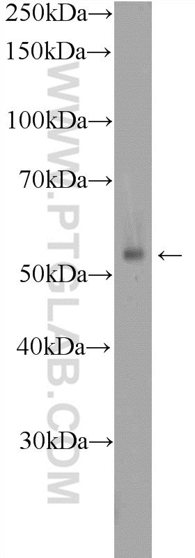 17026-1-AP;mouse spleen tissue