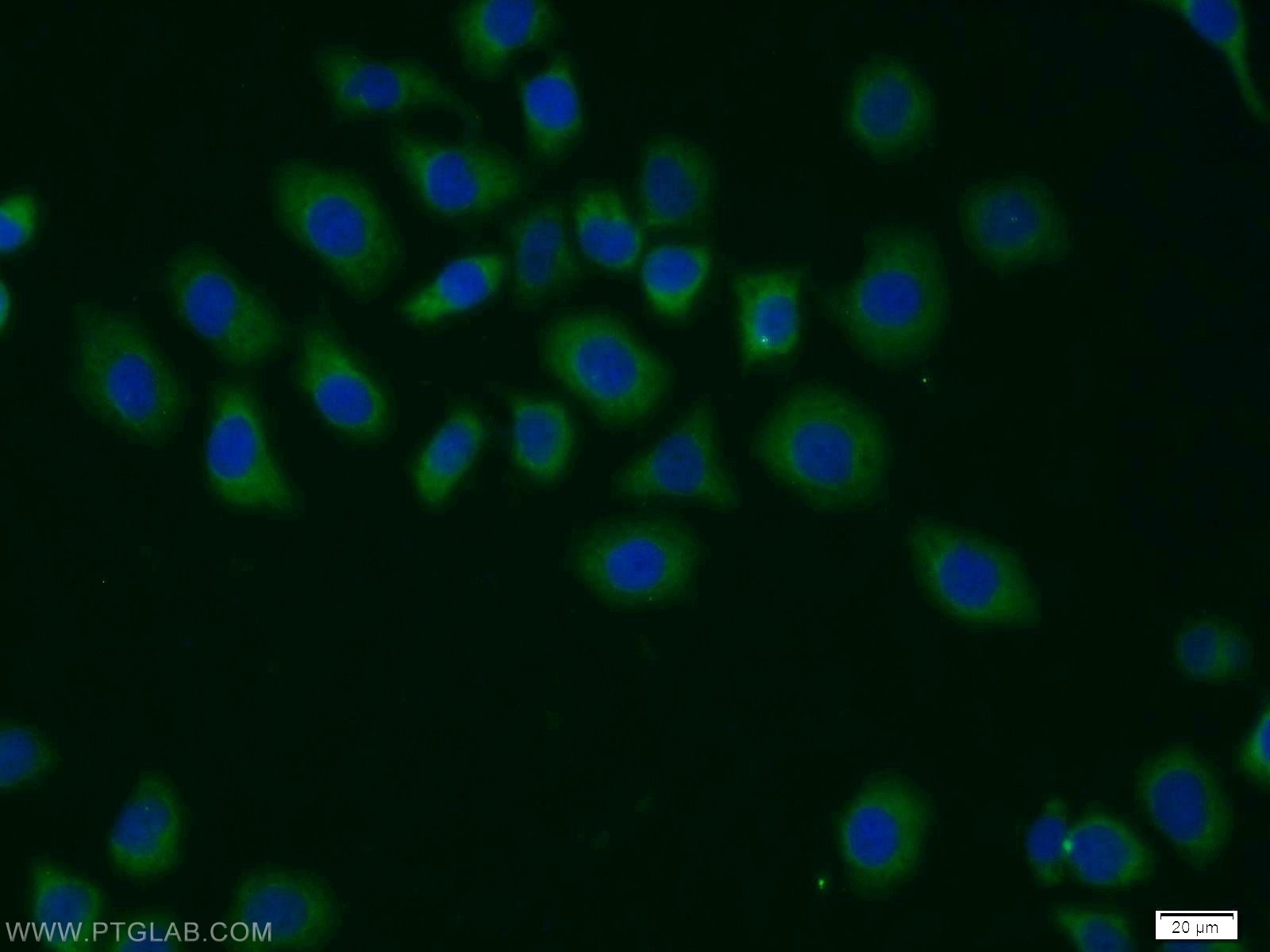 11709-1-AP;MCF-7 cells