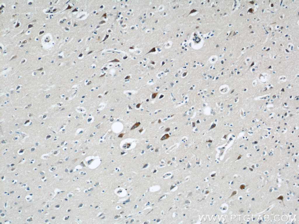 grin2b-antibody-21920-1-ap-proteintech