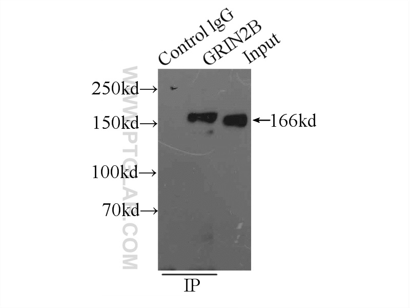 grin2b-antibody-21920-1-ap-proteintech
