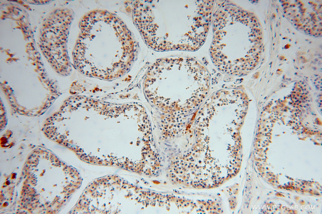 15214-1-AP;human testis
