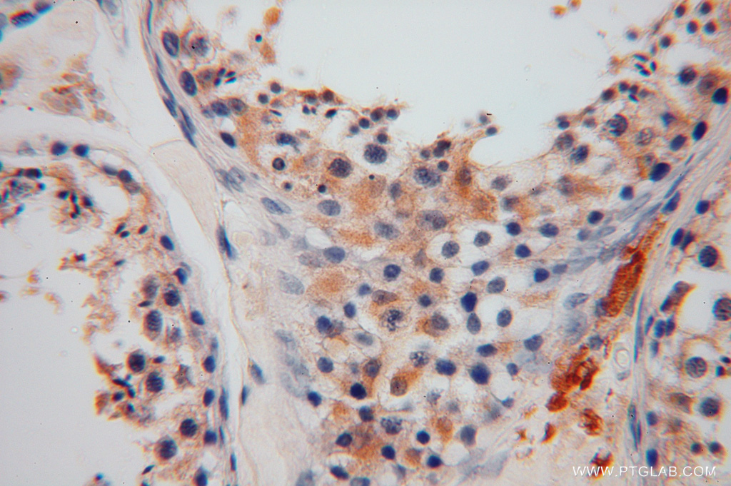 15214-1-AP;human testis
