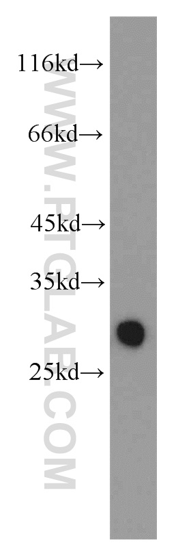 15214-1-AP;human testis tissue