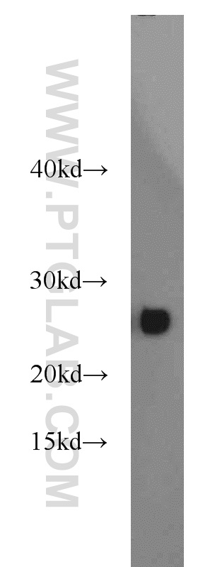 14502-1-AP;mouse testis tissue
