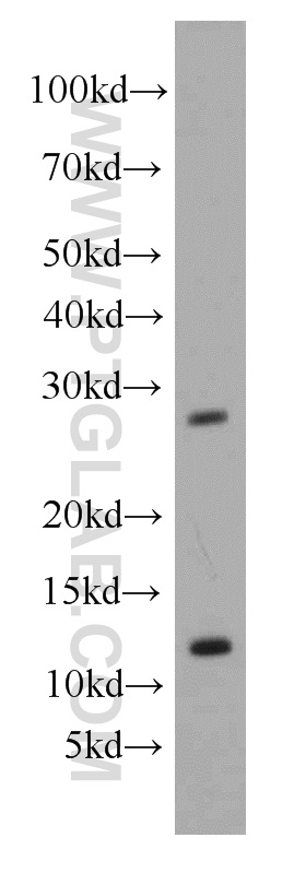 55050-1-AP;mouse liver tissue