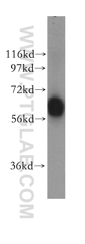 11447-2-AP;human lung tissue