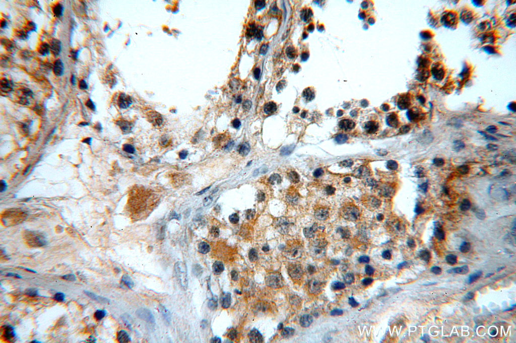 20133-1-AP;human testis