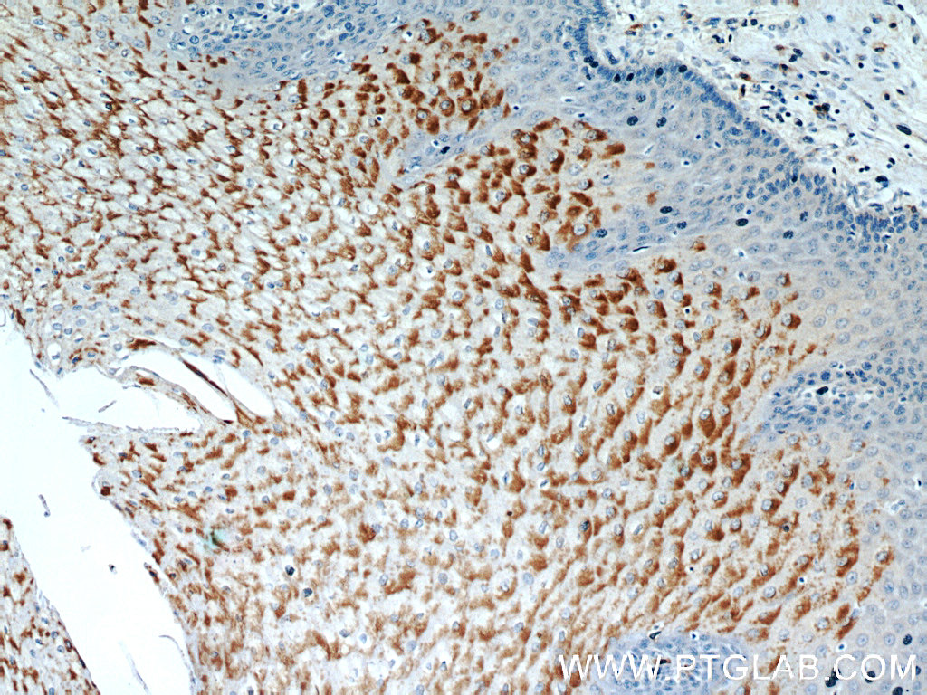 17489-1-AP;human oesophagus