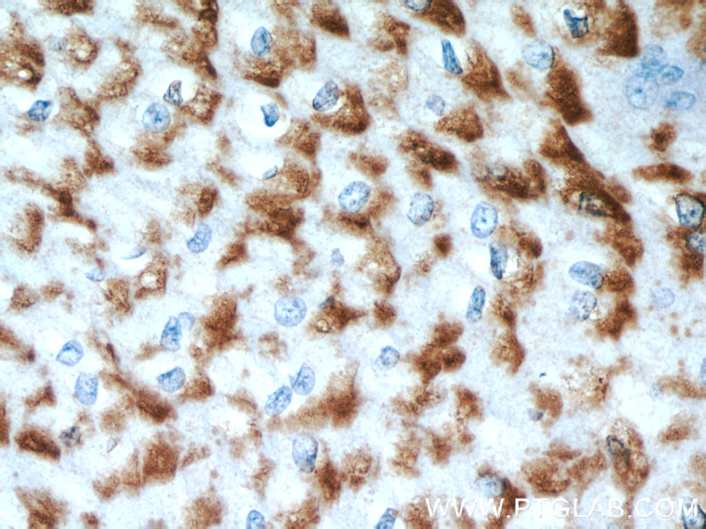 17489-1-AP;human oesophagus