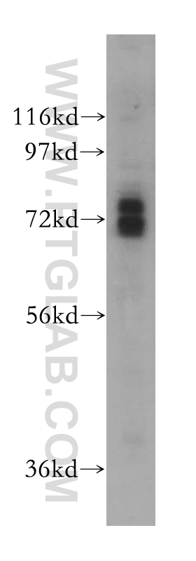 17489-1-AP;HeLa cells