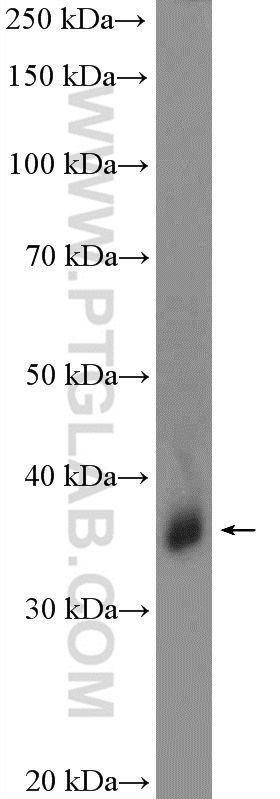 18147-1-AP;human blood tissue