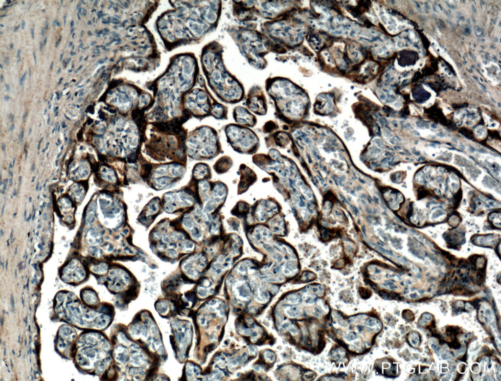 Growth-hormone-Antibody-27079-1-AP-IHC-88248.jpg