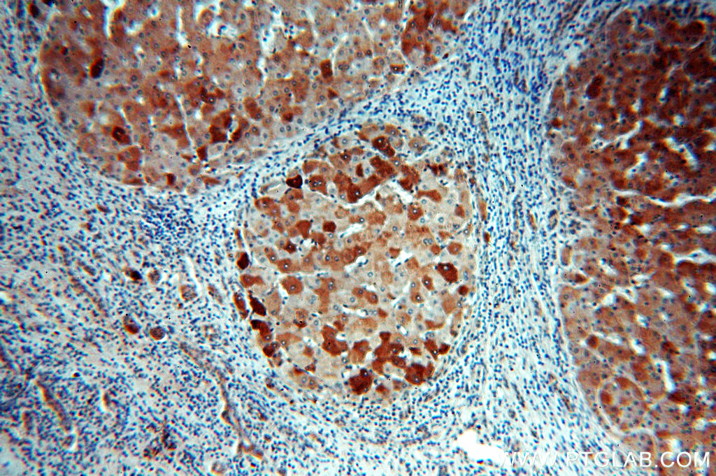 15255-1-AP;human hepatocirrhosis
