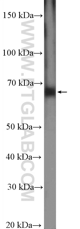 15229-1-AP;mouse spleen tissue