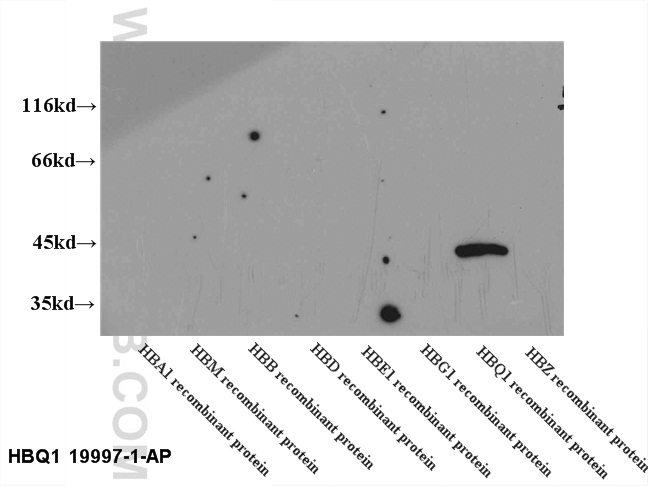 19997-1-AP;recombinant protein