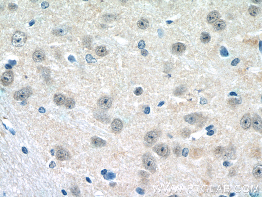 22666-1-AP;mouse brain tissue