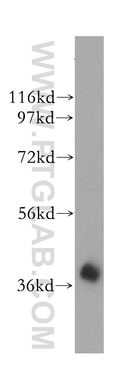 14603-1-AP;human brain tissue