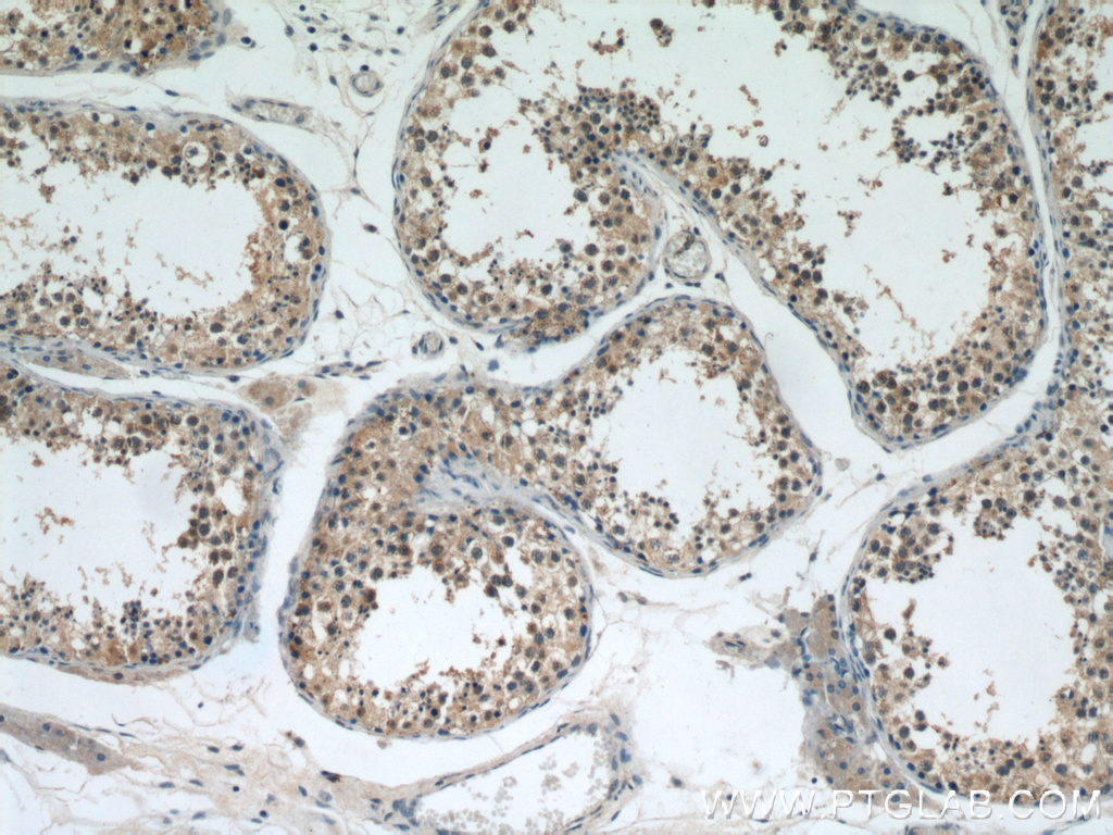 21749-1-AP;human testis