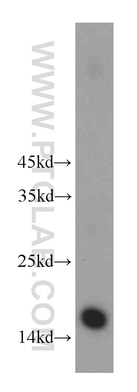 10445-1-AP;human brain tissue