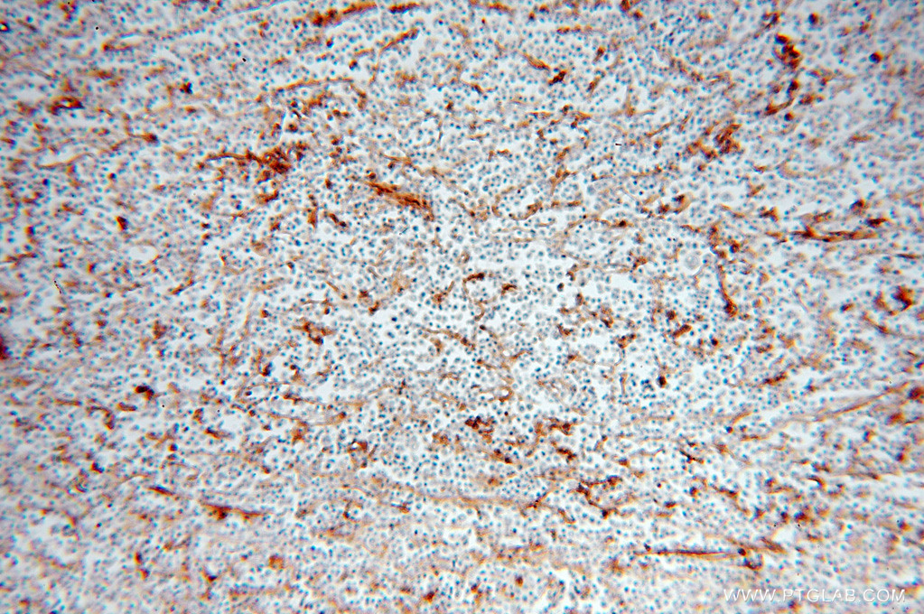 15777-1-AP;human lymphoma