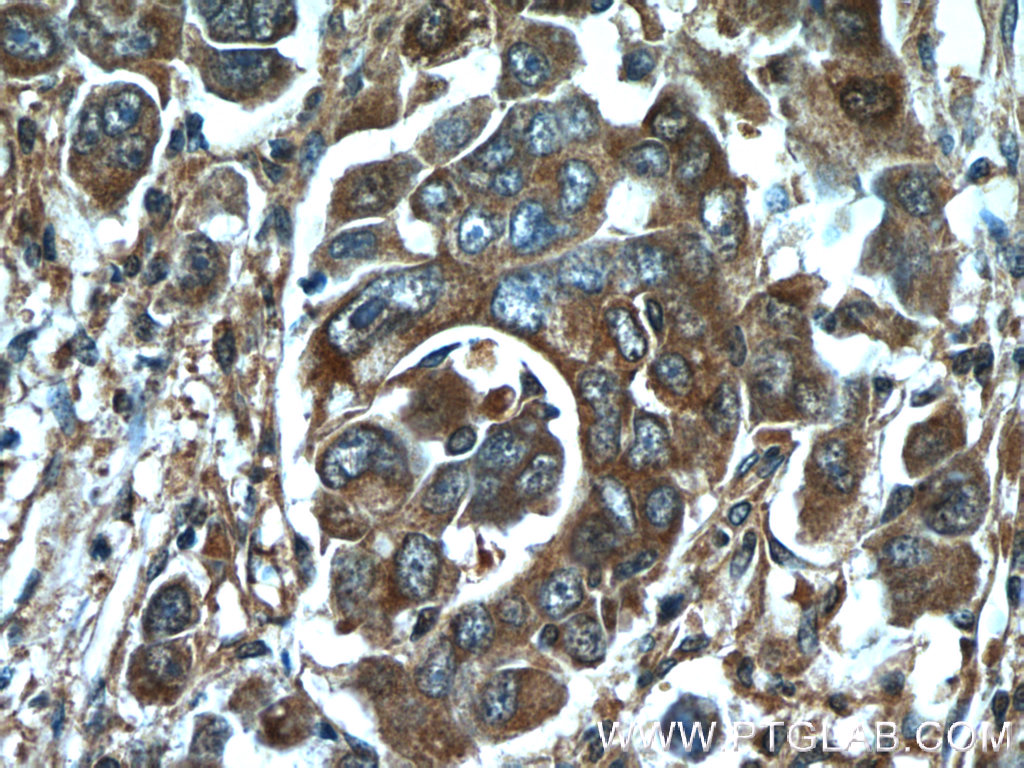 13533-1-AP;human liver cancer tissue