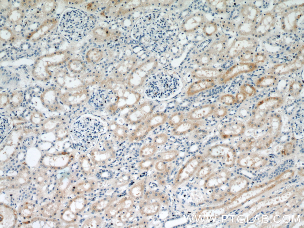 10701-1-AP;human kidney