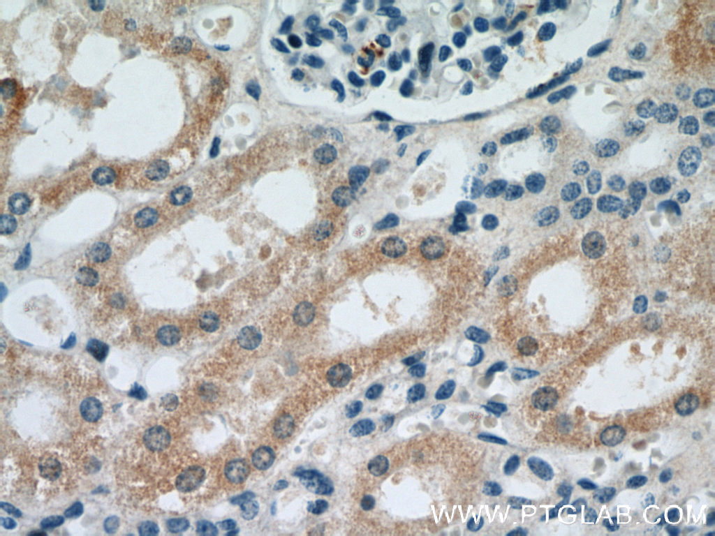 10701-1-AP;human kidney