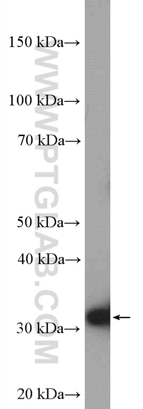 HNRNPA1 Antibody 111761AP Proteintech