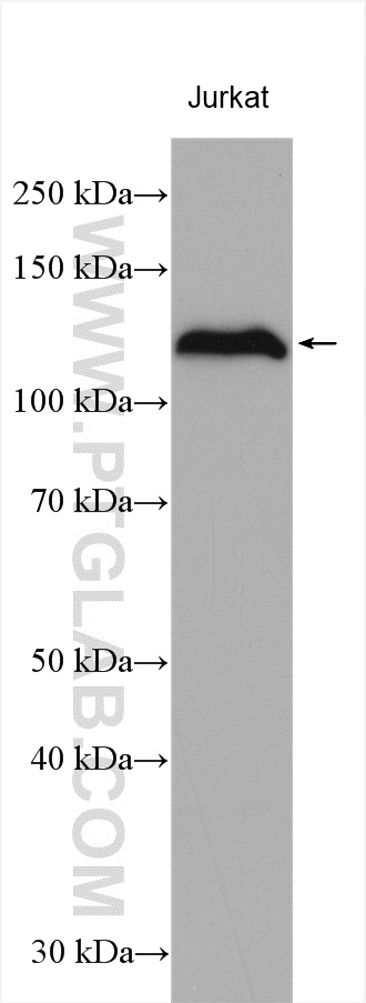 HNRNPU Antibody 163651AP Proteintech