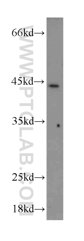 18732-1-AP;mouse liver tissue