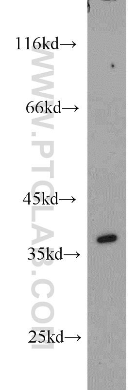 14854-1-AP;MCF7 cell
