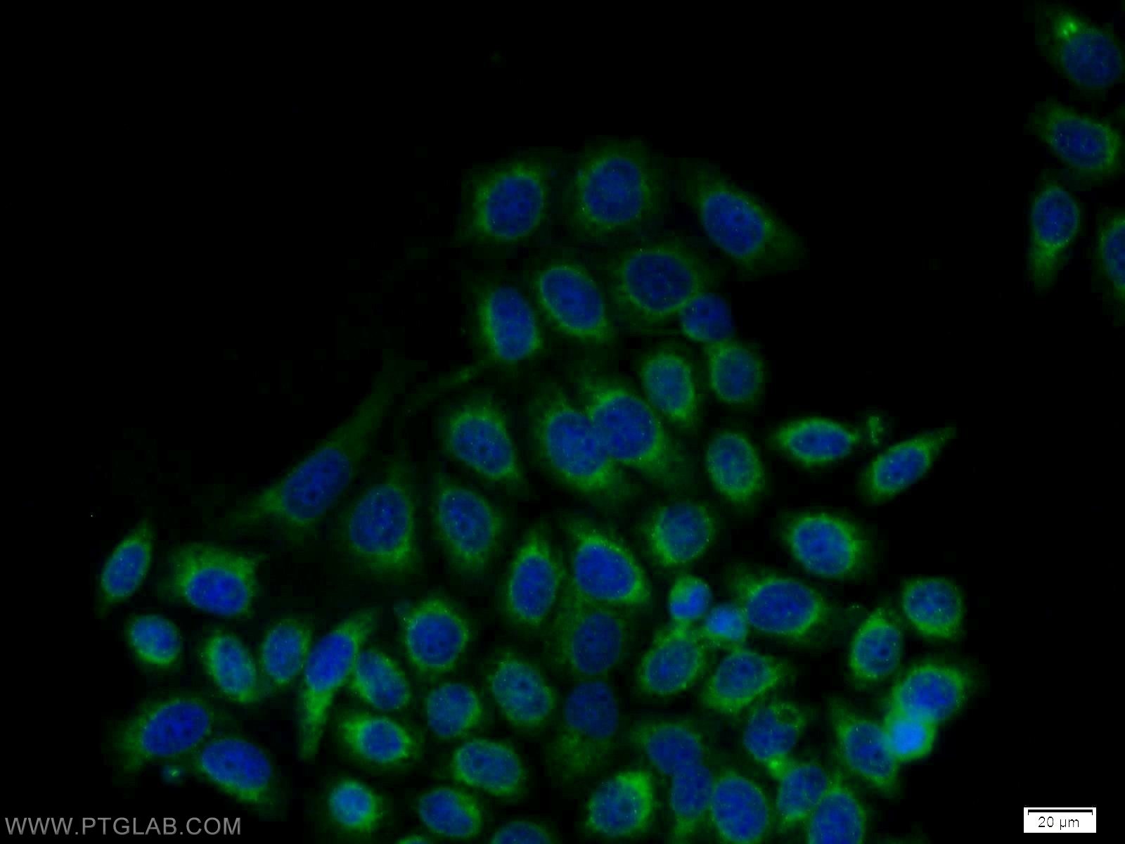 GRP94 Antibody 109791AP Proteintech