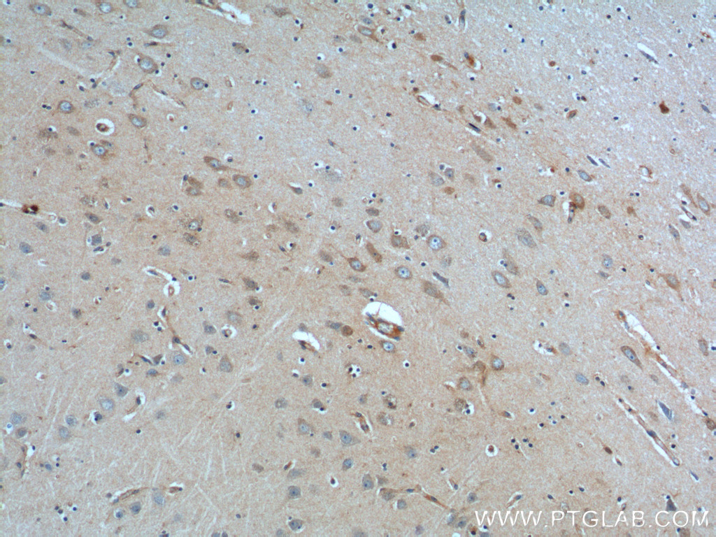 22189-1-AP;human brain tissue