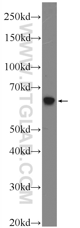 18139-1-AP;mouse testis tissue