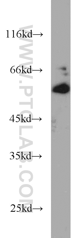 10121-2-AP;Jurkat cells